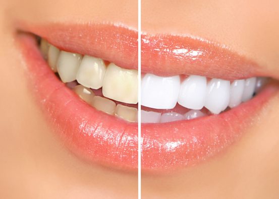A Beutiful Smile Dentistry, Cosmetic Dentist